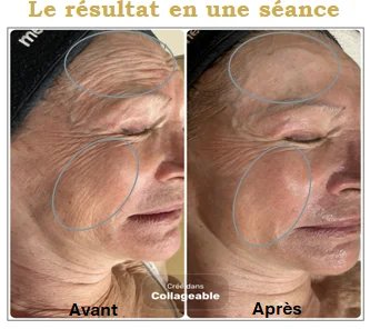 Soin visage Estheskin - Image 1